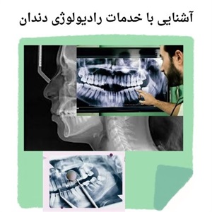 نقش رادیولوژی دندان در تشخیص های دقیق دندان پزشکی