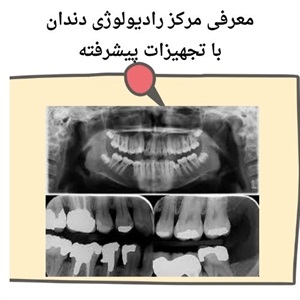 اهمیت خدمات رادیولوژی دندان سعادت آباد در تشخیص مشکلات دندان